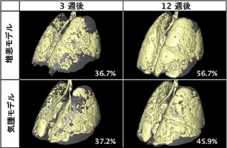 理研など、ヒト慢性閉塞性肺疾患の増悪患者を模倣したモデルマウスを開発