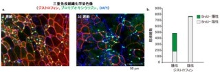 「モルフォリノ人工核酸」はデュシェンヌ型筋ジストロフィーに有効 - NCNP