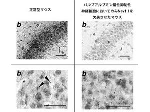 乳児難治てんかんの突然死はタンパク質「Nav1.1」の半減で抑制 - 理研など