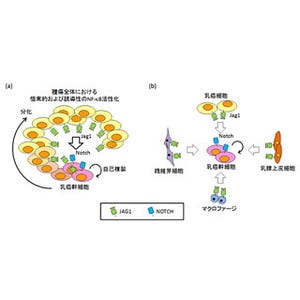 新たな乳がん治療技術に道 -東大、乳腺腫瘍中のがん幹細胞の維持機能を解明