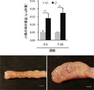 腸管粘膜の異常増殖は細胞内タンパク質輸送因子の異常によるもの -理研など