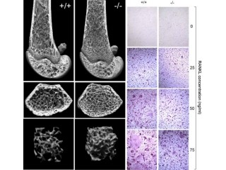 転写調節因子「Sbno2」は次世代の骨粗しょう症治療薬のカギの可能性 - 阪大