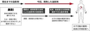 九大など、水以外にも生体分子を高感度検出できるMRI造影剤を開発