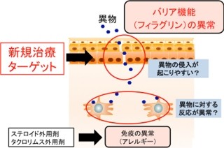 アトピー性皮膚炎は「フィラグリン」の発現の促進で改善可能 - 京大