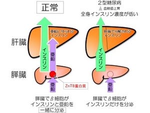 糖尿病の原因の1つに亜鉛の分泌量不足の可能性が浮上 - 順天堂大など