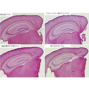 理研、アルツハイマー病発症機構に細胞の自食が関与していることを発見