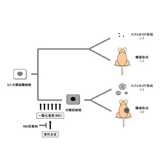 大腸がんの発生原因の1つは一酸化窒素 - 岡山大などが確認