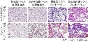 体内の脂肪酸のバランスは肺線維症の発症や症状の悪化に影響 - 群大など