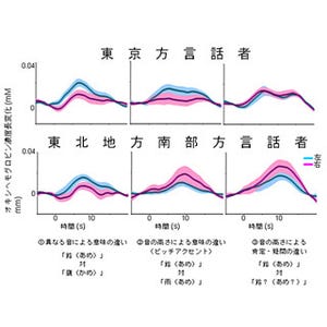 脳の言語処理の仕組みは東京方言話者と東北地方南部方言話者で異なる -理研