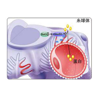 糖尿病の新規治療法の実現に期待 - 慶応大が糖尿病性腎症の発症機構を解明