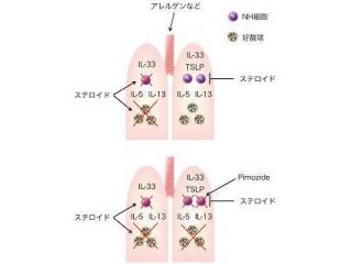 理研など、重症ぜんそくにおいてステロイドが効かなくなる仕組みを解明