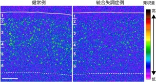 統合失調症患者では大脳皮質の分子「KCNS3」が減少している - 金沢大など