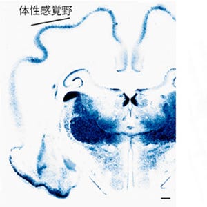 理研、脳神経細胞の樹状突起の形態形成を決定する分子機構の一端を解明