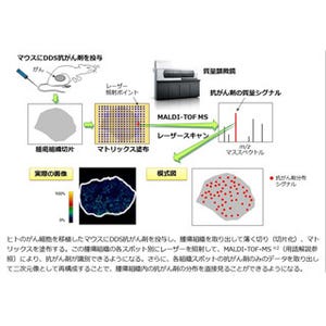 国立がん研、質量顕微鏡によるDDS抗がん剤のイメージングに成功