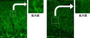 群大など、糖尿病に関連がある遺伝子「CAPS1」の欠損マウスの作製に成功