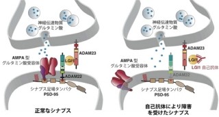 「LGI1」と「ADAM22受容体」の結合は脳の安定な興奮状態の維持必要 - NIPS