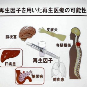 クオリーメンなど、再生因子を使う次世代再生医療の臨床試験を2014年に開始