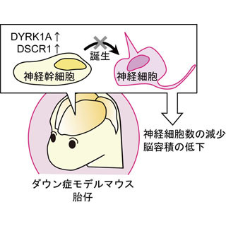ダウン症の脳発生異常は2つの遺伝子の同時過剰発現が原因 - 東大