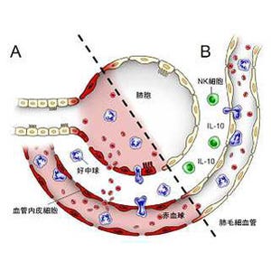 慶応大、心不全患者の呼吸困難を改善する治療法につながるNK細胞の役割を発見