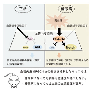 糖尿病になるとなぜ血管の再生能力が衰えるのか? - TMDUなどが原因を解明