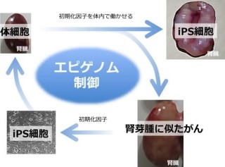 不十分な状態での細胞の初期化はがん化につながる - 京大など