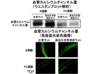 九大、老化した血管で薬剤などによる血管拡張作用が減弱する仕組みを解明