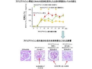 分子「Notch2」の活性化が腎糸球体足細胞の障害を軽減 - 順天堂大