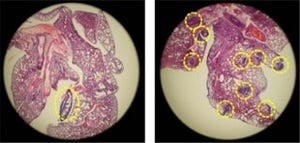 iPS細胞はがん細胞の悪性度や転移能を高める可能性がある - 岡山大が発見