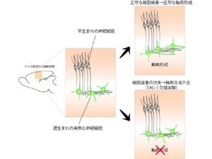 名大、大脳新皮質の神経細胞がどのように「軸索」を形成するのかを解明