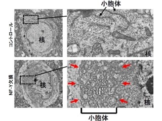 順天堂大、神経細胞の生存には転写因子「NF-Y」が必須都であることを解明