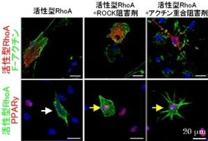 「アクチン細胞骨格」の動態変化が脂肪細胞への分化を誘導する - 慶応大