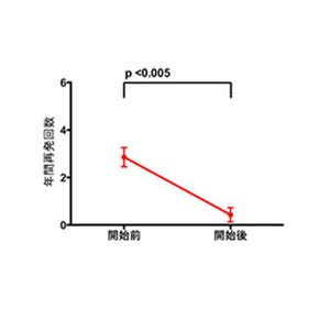 抗IL6受容体薬が視神経脊髄炎の症状を改善