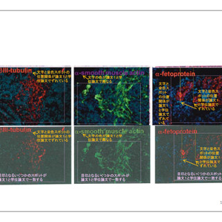 STAP細胞の論文の一部に改ざんとねつ造を確認 - 理研調査委員会が最終報告