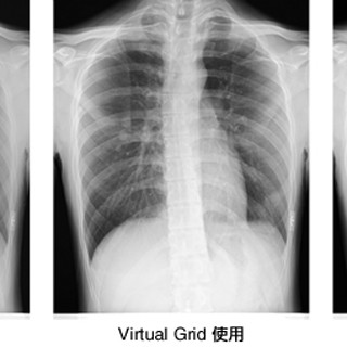 富士フイルム、X線撮像のコントラストを向上できる画像処理ソフトを発表