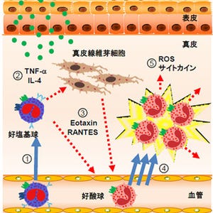 好酸球と好塩基球の相互作用でおむつかぶれは引き起こされる - 京大が解明