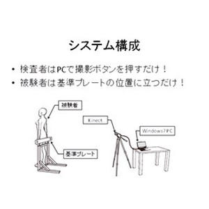 東洋大、Kinectを用いた脊椎側弯症の早期発見システムを開発