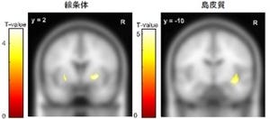 阪大、損得勘定の脳のメカニズムと個人差の一端を解明