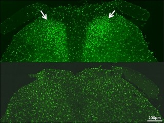 名大など、慢性疲労症候群の原因の一部は「ミクログリア」の活性化の可能性