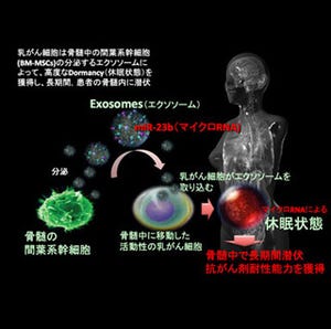 国がん、術後長期間を経て再発・転移する乳がんのメカニズムを解明