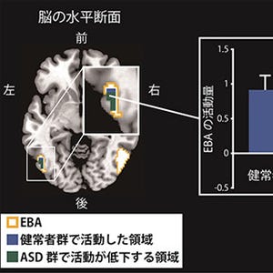 自閉症はなぜ自分の動作を真似されたことを気づくのが苦手なのか - NIPS