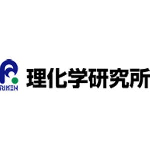 ヒトiPS細胞を用いた滲出型加齢黄斑変性の臨床研究は予定通り推進 - 理研