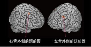 なぜ正直者と嘘つきがいるのか?－京大が脳活動から原因を解明