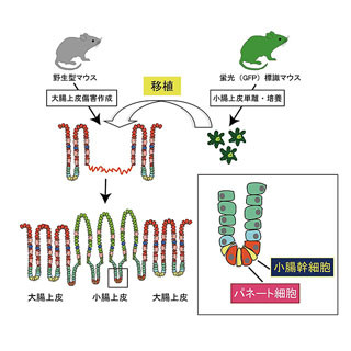 大腸の傷害を小腸の細胞を移植して修復 - 東京医科歯科大学がマウスで成功