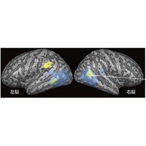 目が見えなくても脳部視覚野の一部は他者の動作を認識すると判明- 生理研