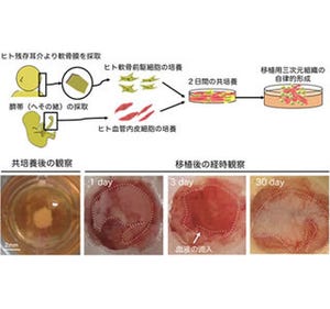 血管使いヒト軟骨の効率的再生に成功