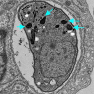 寄生虫「トキソプラズマ」は免疫細胞を利用して感染を拡大する - 大阪大