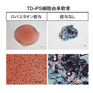 京大、iPS細胞で骨の難病を再現し薬の有効性を確認