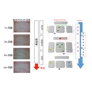 アルツハイマー病の治療法開発に期待 -TMDU、発症前の病態変化の一端を解明