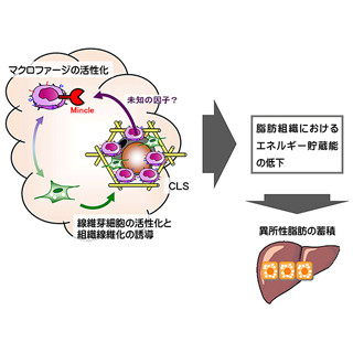 TMDU、肥満に伴う脂肪組織の繊維化を促進させる分子を発見