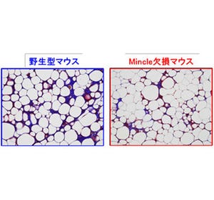 肥満の脂肪組織線維化の鍵分子を発見